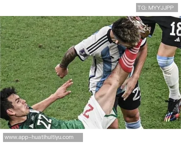 曼晚报道舍什科伤势轻微利桑德罗将加入阿根廷队训练